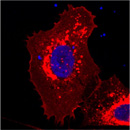 leukemia paper 2017